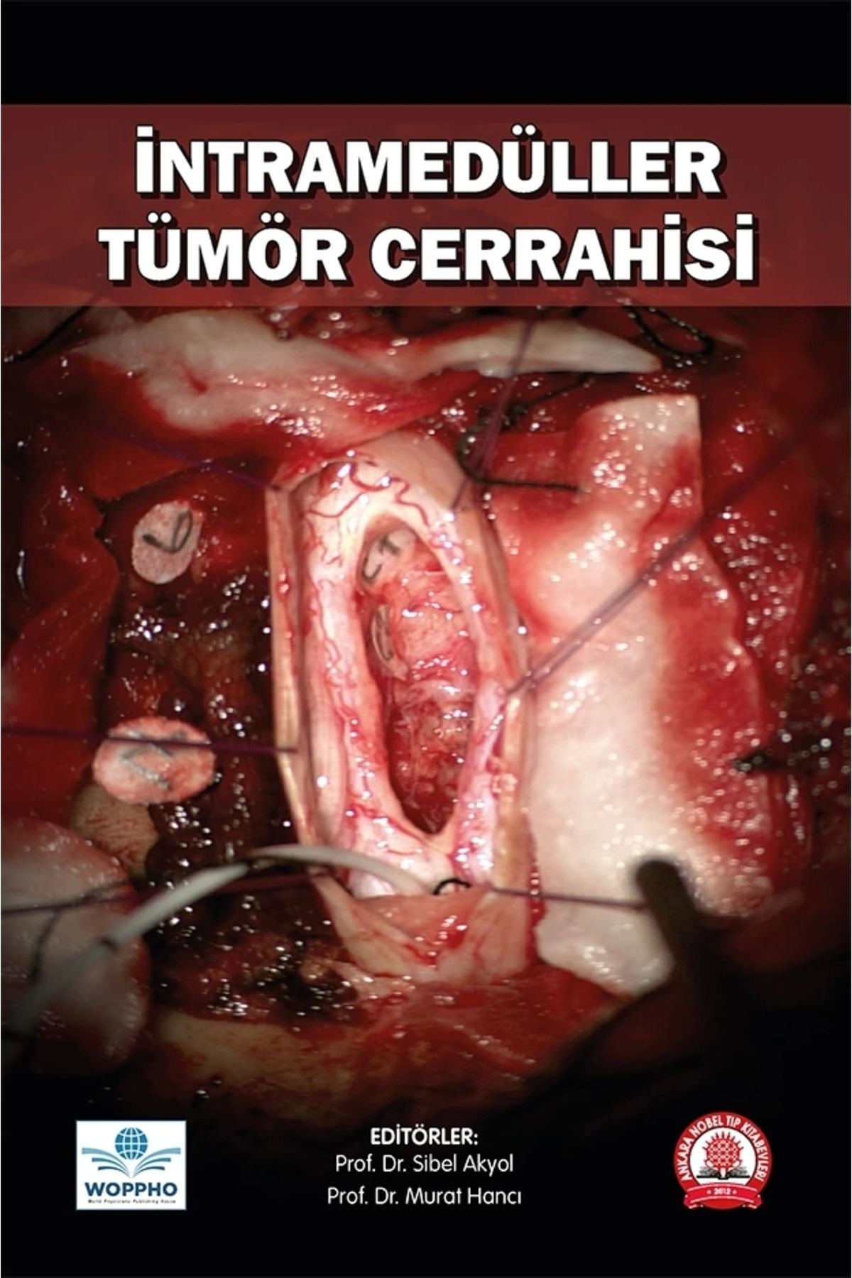 İntramedüller Tümör Cerrahisi kitap kapağı