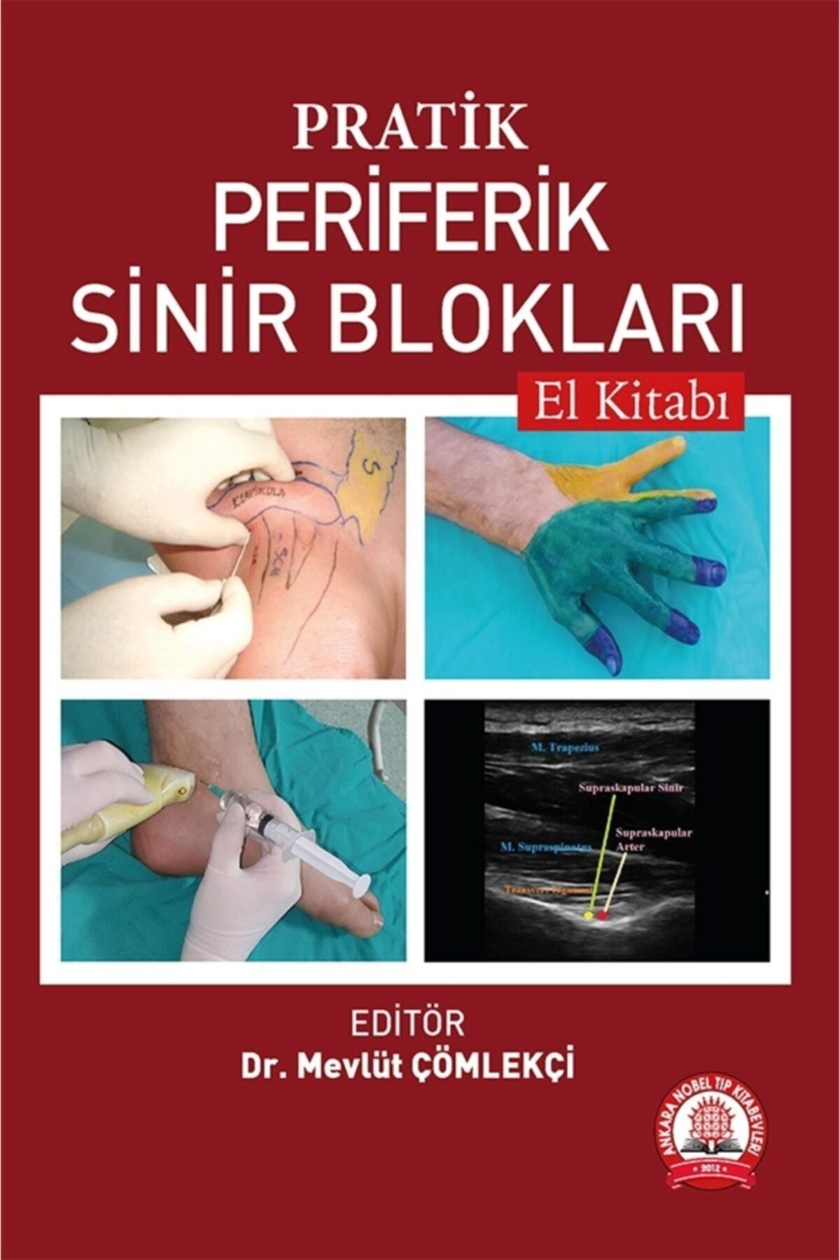 Pratik Periferik Sinir Blokları El Kitabı - UZ.DR. MEVLÜT ÇÖMLEKÇİ kitap kapağı