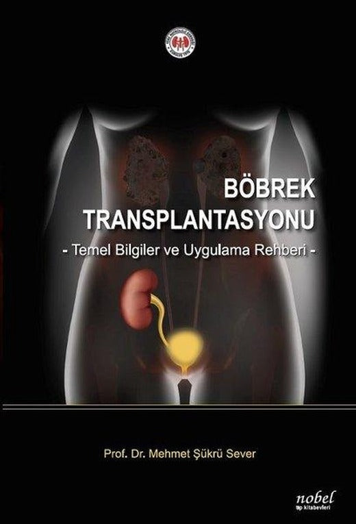 Böbrek Transplantasyonu: Temel Bilgiler ve Uygulama Rehberi | Nobel Tıp Kitabevleri (İnce Kapak)