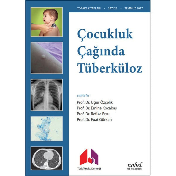 Çocukluk Çağında Tüberküloz | Nobel Tıp Kitabevleri (İnce Kapak)