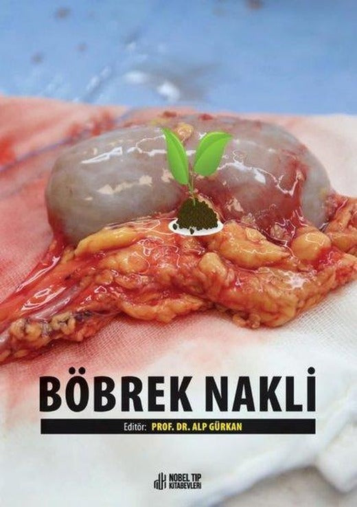 Böbrek Nakli | Nobel Tıp Kitabevleri (İnce Kapak)