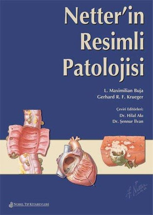 Netter'İn Resimli Patolojisi | Nobel Tıp Kitabevleri (İnce Kapak)