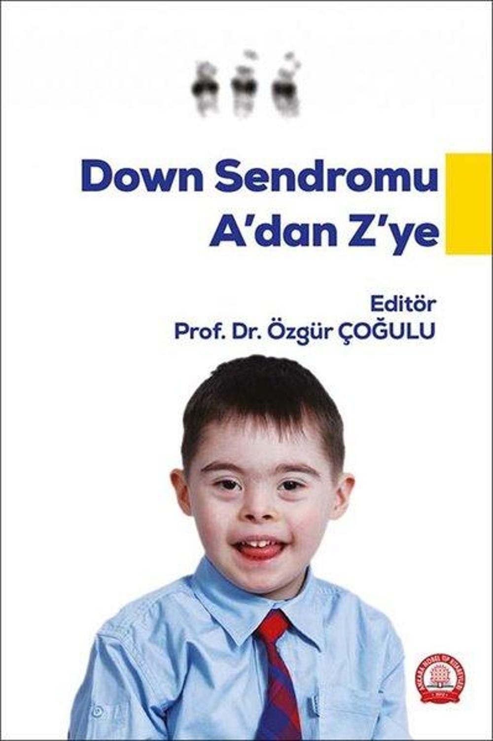 Down Sendromu A'dan Z'ye | Ankara Nobel Tıp