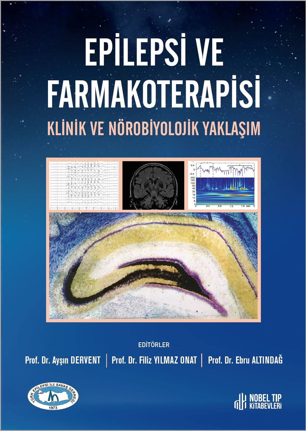 Epilepsi ve Farmakoterapisi Klinik ve Nörobiyolojik Yaklaşım - Prof. Dr. Ayşın DERVENT, Prof. Dr. Filiz kitap kapağı