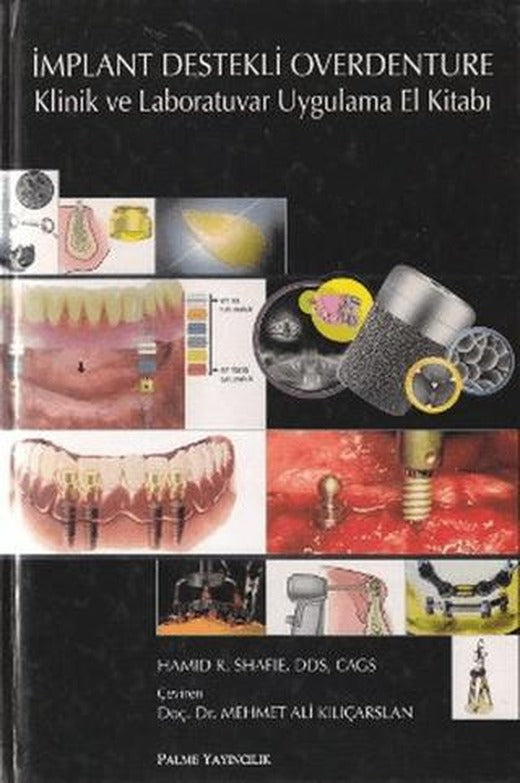 İmplant Destekli Overdenture | Palme Yayıncılık (Ciltli)
