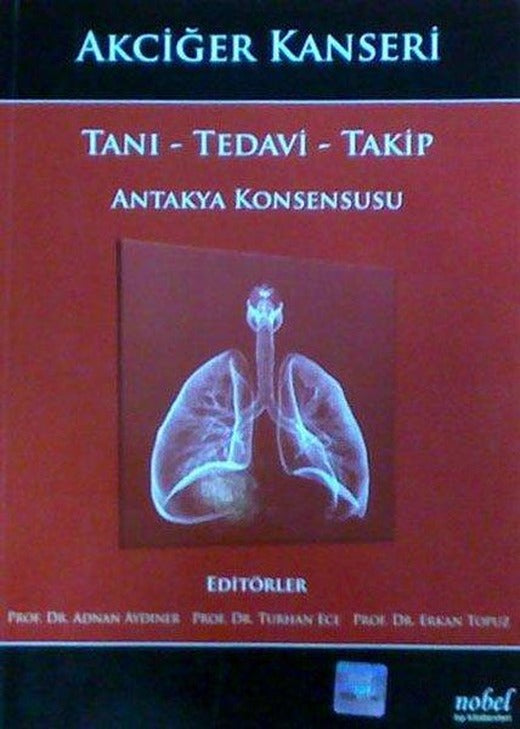 Akciğer Kanseri Tanı - Tedavi-Takip Antakya Konsen. | Nobel Tıp Kitabevleri (İnce Kapak)