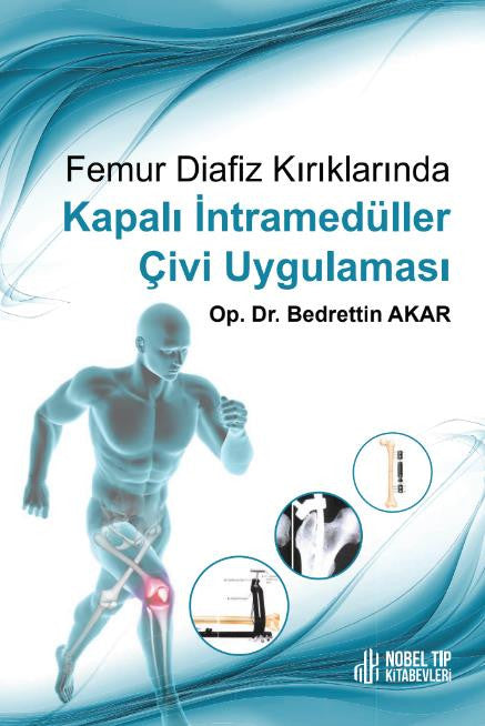 Femur Diafiz Kırıklarında Kapalı İntramedüller Çivi Uygulaması kitap kapağı