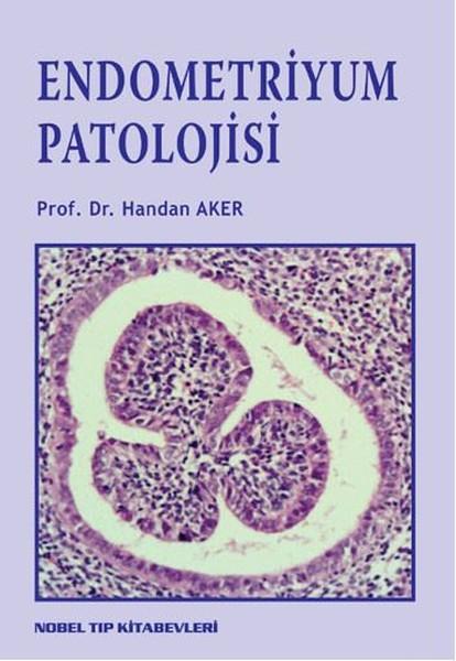 Endometriyum Patolojisi | Nobel Tıp Kitabevleri - Sağlık Dizisi (İnce Kapak)  - Resim 1