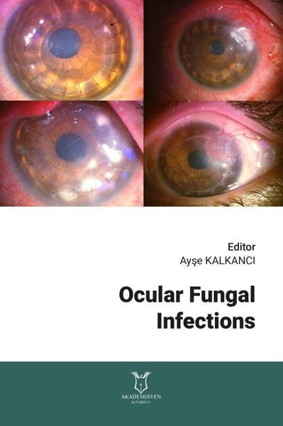Ocular Fungal Infections - Kolektif kitap kapağı