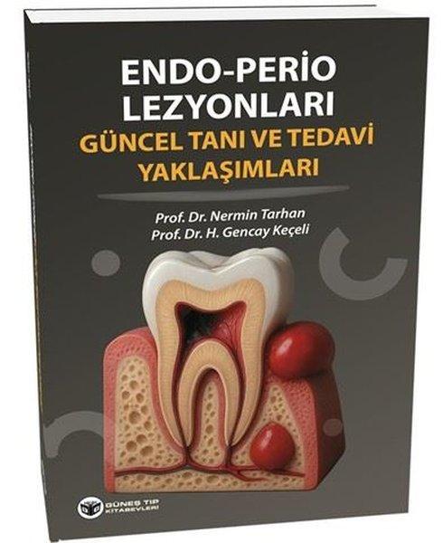Endo - Perio Lezyonları Güncel Tanı ve Tedavi Yaklaşımları
