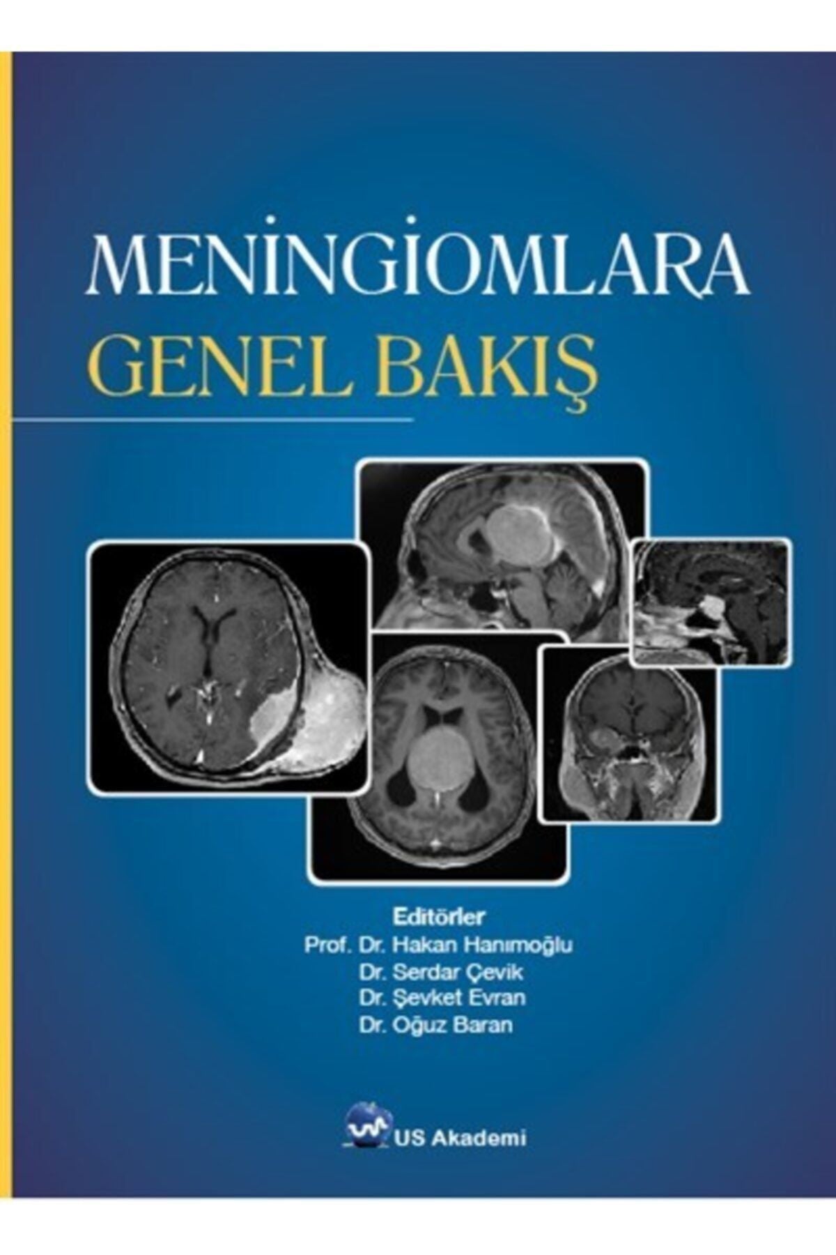 Us Akademi Meningiomlara Genel Bakış - EDİTÖR: Dr. Ulunay KANATLI kitap kapağı
