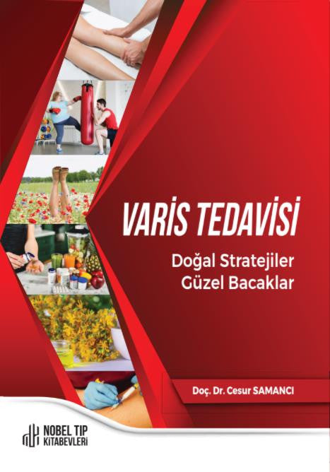 Varis Tedavisi Doğal Stratejiler,Güzel Bacaklar kitap kapağı